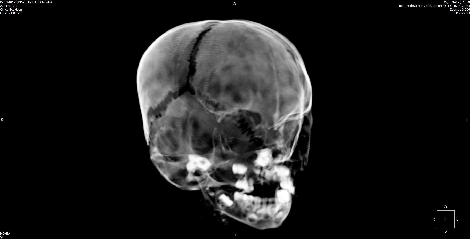 Face Examination