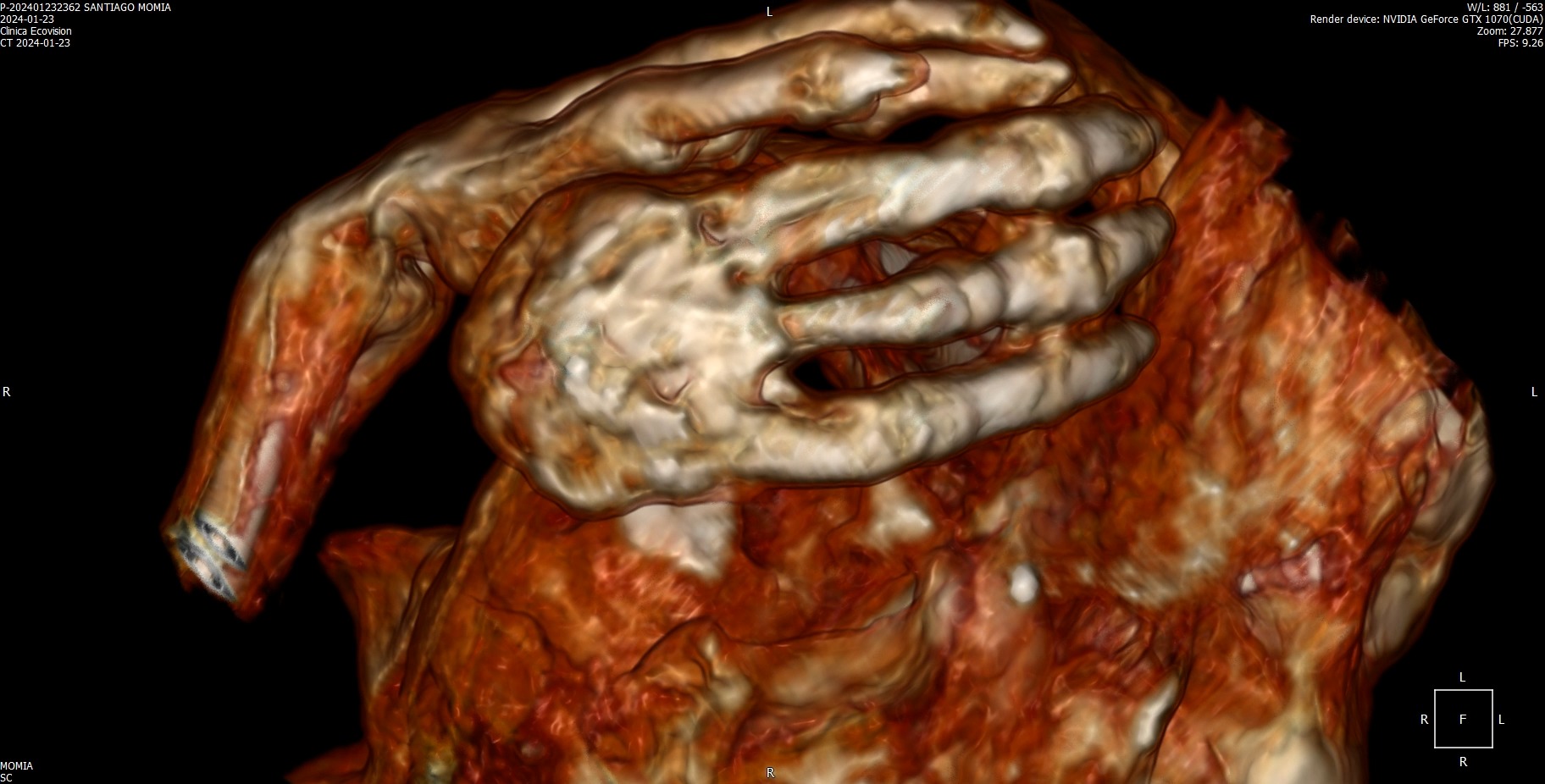 Hand Examination