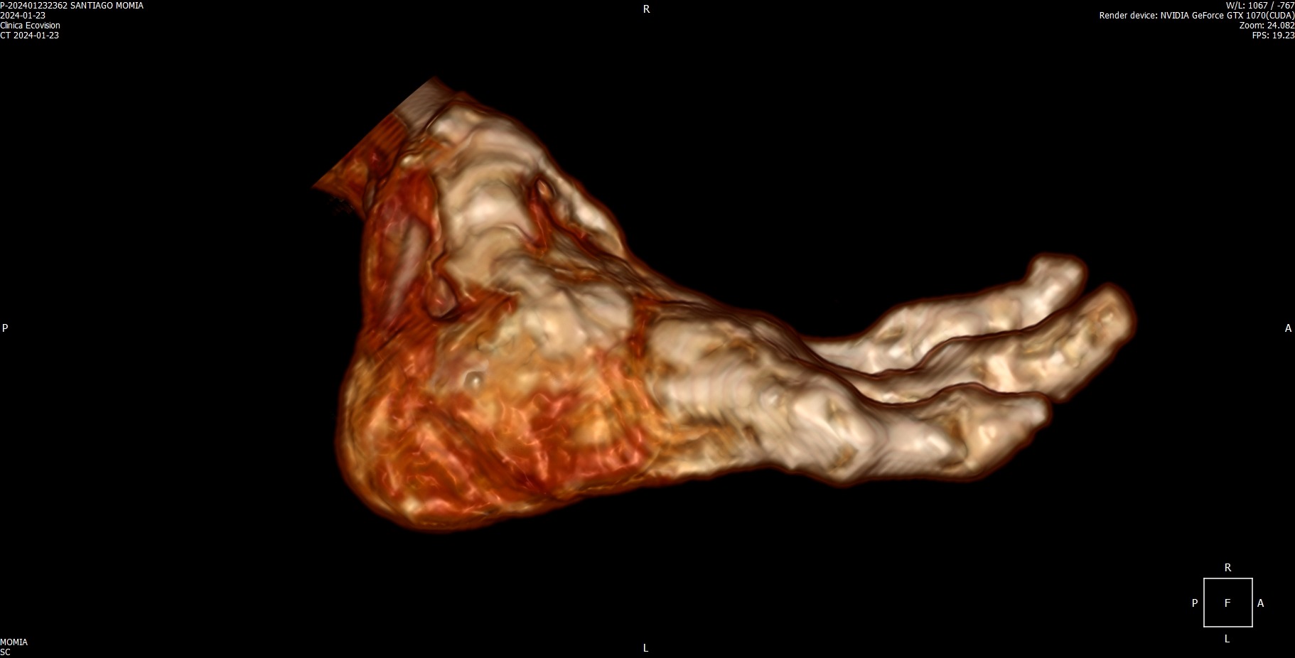 Medical Scan of Santiago