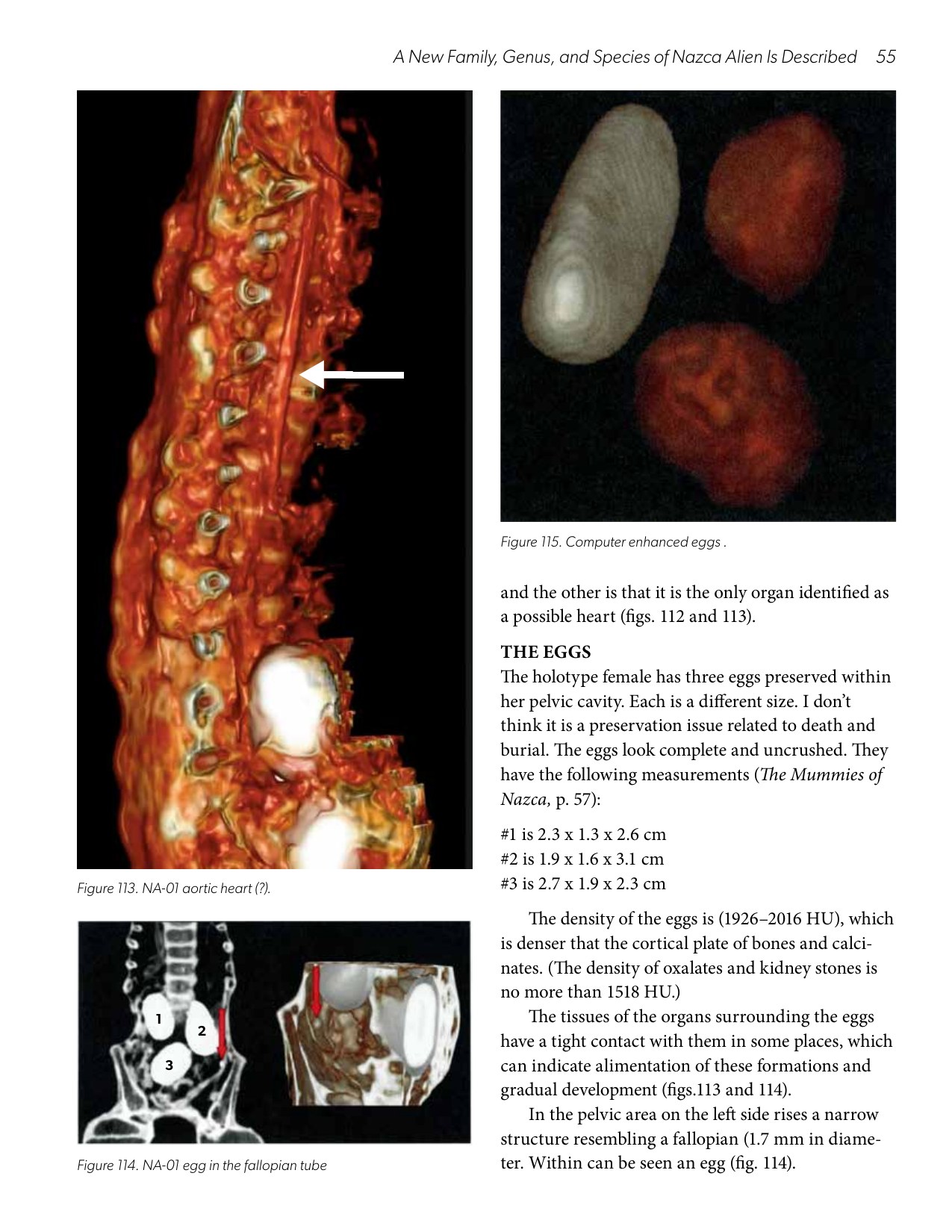 Report page 55 - Figures 113-115: internal anatomy and the three egg-shaped structures