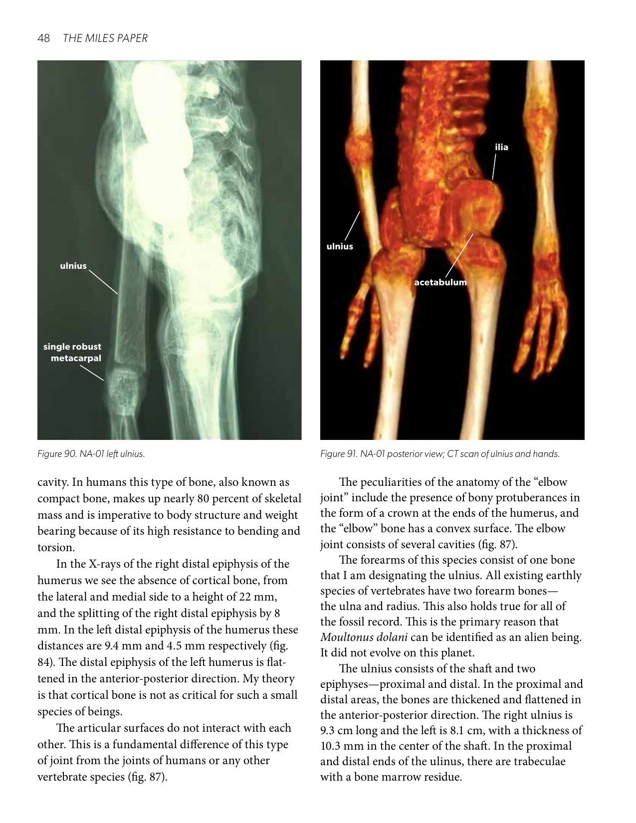 Report page 48 - Figures 90-91: the proposed single forearm bone and hand anatomy